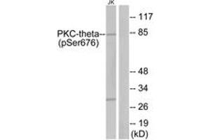 Western Blotting (WB) image for anti-Protein Kinase C, theta (PRKCQ) (pSer676) antibody (ABIN2888514) (PKC theta 抗体  (pSer676))