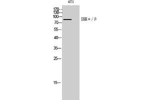 Western Blot analysis of 4T1 cells using IKKα/β Polyclonal Antibody diluted at 1:1000. (IKK-alpha /IKK-beta 抗体)