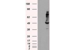 Image no. 2 for anti-Intraflagellar Transport 57 Homolog (IFT57) antibody (ABIN1498809) (IFT57 抗体)