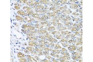 Immunohistochemistry of paraffin-embedded Mouse stomach using RAC2 Polyclonal Antibody at dilution of 1:100 (40x lens). (RAC2 抗体)