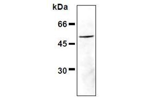 Western Blotting (WB) image for anti-Vimentin (VIM) (pSer33) antibody (ABIN1449152) (Vimentin 抗体  (pSer33))