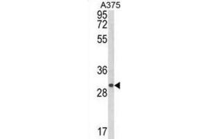 Western Blotting (WB) image for anti-Collagen Triple Helix Repeat Containing 1 (CTHRC1) antibody (ABIN3003906) (CTHRC1 抗体)