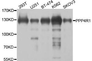 Western blot analysis of extracts of various cell lines, using PPP4R1 antibody (ABIN5974671) at 1/1000 dilution. (PPP4R1 抗体)