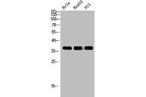 Western Blot analysis of HELA HEPG2 PC-3 using p38 Polyclonal Antibody. (MAPK14 抗体  (C-Term))