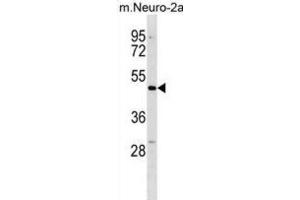 Western Blotting (WB) image for anti-Doublecortin Domain Containing 2 (DCDC2) antibody (ABIN3000420) (DCDC2 抗体)