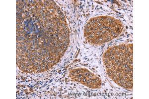 Immunohistochemistry of Human tonsil using CLUAP1 Polyclonal Antibody at dilution of 1:50 (CLUAP1 抗体)