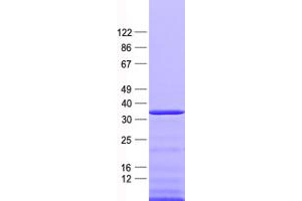 Nkx2-2 Protein (His tag)