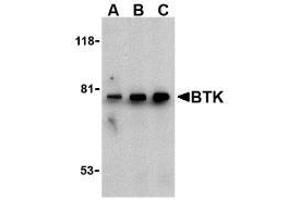 Image no. 2 for anti-Bruton Agammaglobulinemia tyrosine Kinase (BTK) (N-Term) antibody (ABIN206839) (BTK 抗体  (N-Term))