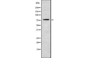 Western blot analysis GOLM1 using Jurkat whole cell lysates (GOLM1 抗体  (C-Term))