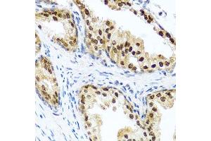 Immunohistochemistry of paraffin-embedded human prostate using RAD23B antibody. (RAD23B 抗体  (AA 50-150))