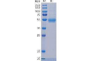 Human IL5RA Protein, His Tag on SDS-PAGE under reducing condition. (IL5RA Protein (AA 21-338) (His tag))