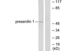 Western Blotting (WB) image for anti-Presenilin 1 (PSEN1) (N-Term) antibody (ABIN1848749) (Presenilin 1 抗体  (N-Term))