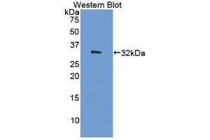 Detection of Recombinant DNMT1, Human using Polyclonal Antibody to DNA Methyltransferase 1 (DNMT1) (DNMT1 抗体  (AA 1343-1570))