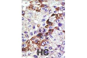 Immunohistochemistry (IHC) image for anti-Ubiquitin-Conjugating Enzyme E2E 3 (UBE2E3) antibody (ABIN3001488) (UBE2E3 抗体)