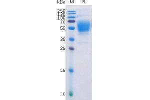 Human CB1 Protein, hFc Tag on SDS-PAGE under reducing condition. (CNR1 Protein (AA 1-116) (Fc Tag))