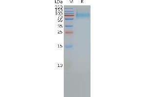 Human S-Nanodisc, His/Flag Tag on SDS-PAGE (SSTR2 蛋白)