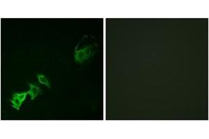 Immunofluorescence (IF) image for anti-C-Abl Oncogene 1, Non-Receptor tyrosine Kinase (ABL1) (pTyr393) antibody (ABIN2888351) (ABL1 抗体  (pTyr393))