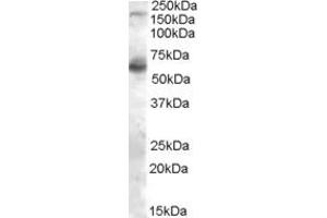 Western Blotting (WB) image for anti-Nitric Oxide Synthase 1, Neuronal (NOS1) (C-Term) antibody (ABIN184662)