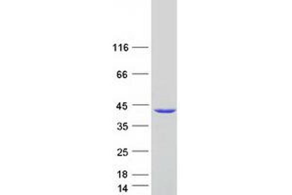 STARD7 Protein (Transcript Variant 2) (Myc-DYKDDDDK Tag)