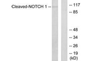 Western blot analysis of extracts from NIH-3T3 cells, treated with Etoposide 25uM 60', using Notch 1 (Cleaved-Val1754) Antibody. (Notch1 抗体  (Cleaved-Val1754))