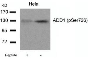Western blot analysis of extracts from Hela cells using ADD1(Phospho-Ser726) Antibody and the same antibody preincubated with blocking peptide. (alpha Adducin 抗体  (pSer726))