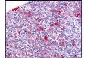 Human Tonsil: Formalin-Fixed, Paraffin-Embedded (FFPE) (Girdin 抗体  (C-Term))