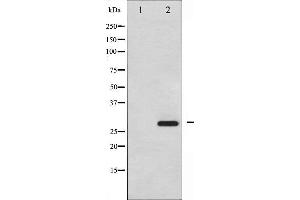 Western blot analysis of HSP27 phosphorylation expression in UV treated HeLa whole cell lysates,The lane on the left is treated with the antigen-specific peptide. (HSP27 抗体  (pSer15))