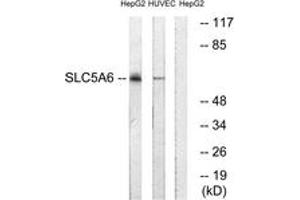 Western Blotting (WB) image for anti-Solute Carrier Family 5 (Iodide Transporter), Member 6 (SLC5A6) (AA 551-600) antibody (ABIN2890649) (SLC5A6 抗体  (AA 551-600))