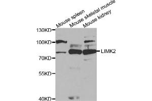 Western blot analysis of extracts of various cell lines, using LIMK2 antibody (ABIN5973137) at 1/1000 dilution. (LIMK2 抗体)