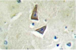 Immunohistochemical analysis using CD4 antibody in Paraffin-embedded human brain tissue. (CD4 抗体)