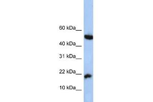 WB Suggested Anti-LOC285033 Antibody Titration: 0. (LOC285033 抗体  (N-Term))