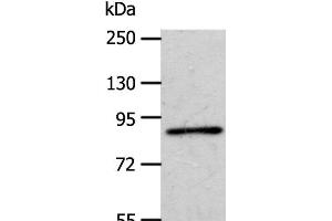 Western Blot analysis of A172 cell using APPL1 Polyclonal Antibody at dilution of 1:600 (APPL1 抗体)