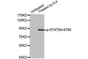 Western blot analysis of extracts from K562 cells using Phospho-STAT5A-S780 antibody (ABIN2987413). (STAT5A 抗体  (pSer780))