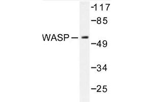 Image no. 1 for anti-Wiskott-Aldrich Syndrome (Eczema-thrombocytopenia) (WAS) antibody (ABIN272092) (WASP 抗体)