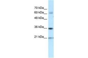 Image no. 1 for anti-Pim-1 Oncogene (PIM1) (N-Term) antibody (ABIN6741658) (PIM1 抗体  (N-Term))