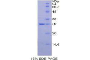 SDS-PAGE analysis of Rat TIMP3 Protein. (TIMP3 蛋白)