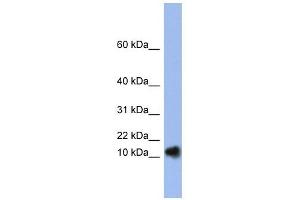 RNASE1 antibody used at 1 ug/ml to detect target protein. (RNASE1 抗体)