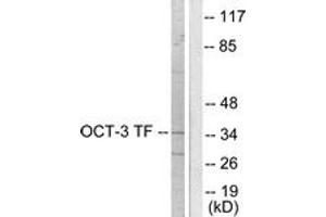 Western Blotting (WB) image for anti-POU Class 5 Homeobox 1 (POU5F1) (AA 191-240) antibody (ABIN2889240) (OCT4 抗体  (AA 191-240))