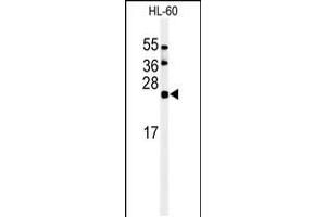 Western blot analysis of in HL-60 cell line lysates (35ug/lane) (ISG15 抗体  (C-Term))