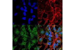 Immunocytochemistry/Immunofluorescence analysis using Rabbit Anti-UVRAG Polyclonal Antibody . (UVRAG 抗体  (Biotin))