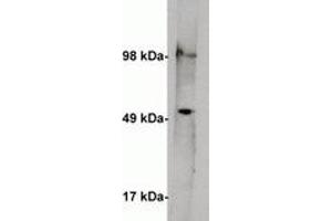 Image no. 1 for anti-serine Palmitoyltransferase, Long Chain Base Subunit 1 (SPTLC1) antibody (ABIN201813) (SPTLC1 抗体)