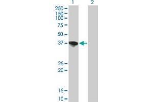 Western Blotting (WB) image for anti-Sorbitol Dehydrogenase (SORD) (AA 1-110) antibody (ABIN562952)