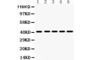 Anti- HOXA10 antibody, Western blotting All lanes: Anti HOXA10  at 0. (HOXA10 抗体  (AA 57-340))