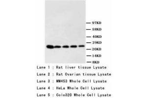 Image no. 1 for anti-Phosphoserine antibody (ABIN1495566) (Phosphoserine 抗体)