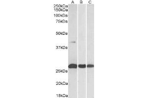 ABIN2562312 (0. (DUSP6 抗体  (C-Term))