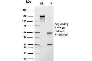 SDS-PAGE Analysis Purified Frataxin Recombinant Mouse Monoclonal Antibody (rFXN/2124). (Recombinant Frataxin 抗体  (AA 57-210))