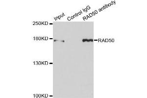 Immunoprecipitation analysis of 150 μg extracts of MCF7 cells using 3 μg RAD50 antibody (ABIN5971576). (RAD50 抗体)