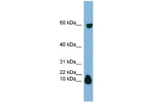 WB Suggested Anti-STATH Antibody Titration:  0. (STATH 抗体  (Middle Region))