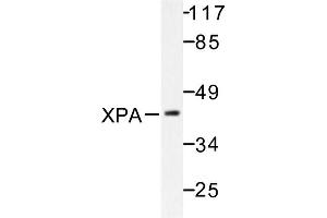 Image no. 1 for anti-Xeroderma Pigmentosum, Complementation Group A (XPA) antibody (ABIN271978) (XPA 抗体)