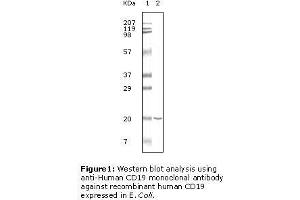 Image no. 2 for anti-CD19 Molecule (CD19) antibody (ABIN207604) (CD19 抗体)